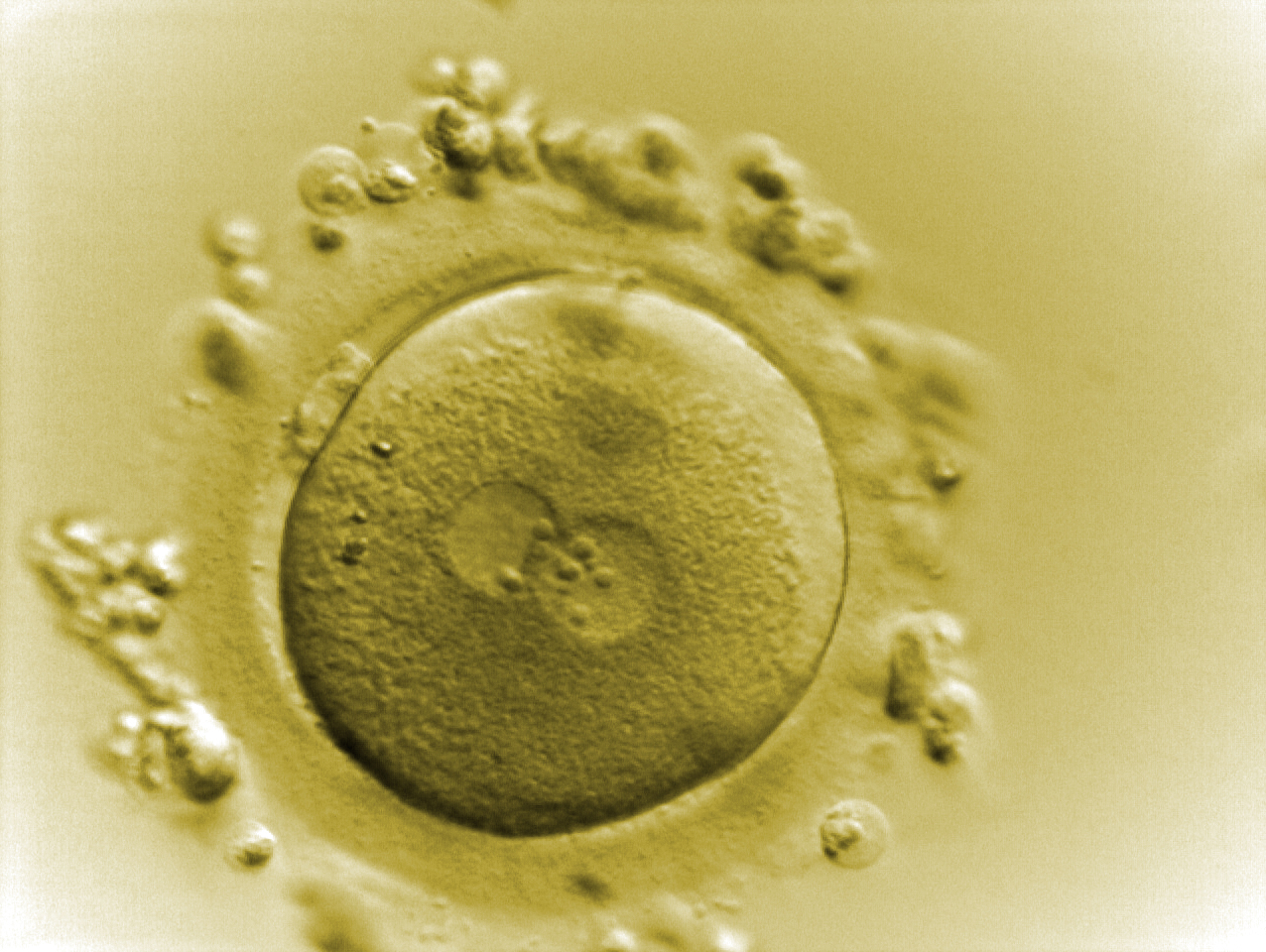 Embryon au stade zygote (1 jour)